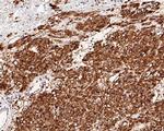 DOG-1 Antibody in Immunohistochemistry (Paraffin) (IHC (P))