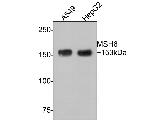 MSH6 Antibody in Western Blot (WB)