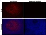 CD21 Antibody in Immunohistochemistry (Paraffin) (IHC (P))