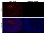 CD21 Antibody in Immunohistochemistry (Paraffin) (IHC (P))