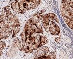 UPK3A Antibody in Immunohistochemistry (Paraffin) (IHC (P))