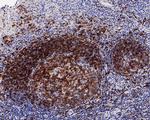 CD22 Antibody in Immunohistochemistry (Paraffin) (IHC (P))