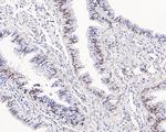 Androgen Receptor Antibody in Immunohistochemistry (Paraffin) (IHC (P))