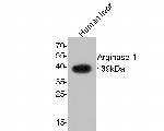 Arginase 1 Antibody in Western Blot (WB)