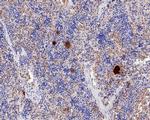 TGF beta-1 Antibody in Immunohistochemistry (Paraffin) (IHC (P))