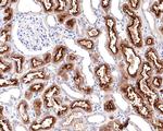 Villin Antibody in Immunohistochemistry (Paraffin) (IHC (P))