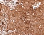 PEX11B Antibody in Immunohistochemistry (Paraffin) (IHC (P))