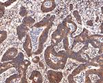 PEX11B Antibody in Immunohistochemistry (Paraffin) (IHC (P))