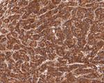 PEX11B Antibody in Immunohistochemistry (Paraffin) (IHC (P))