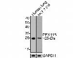 PEX11B Antibody in Western Blot (WB)