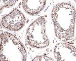 CECR5 Antibody in Immunohistochemistry (Paraffin) (IHC (P))