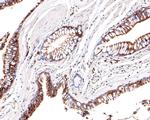 UFC1 Antibody in Immunohistochemistry (Paraffin) (IHC (P))