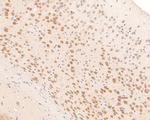 PCBP2 Antibody in Immunohistochemistry (Paraffin) (IHC (P))