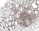 TAF3 Antibody in Immunohistochemistry (Paraffin) (IHC (P))