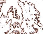 TAF3 Antibody in Immunohistochemistry (Paraffin) (IHC (P))