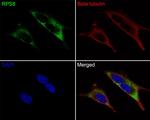 RPS8 Antibody in Immunocytochemistry (ICC/IF)