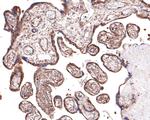 RPS8 Antibody in Immunohistochemistry (Paraffin) (IHC (P))