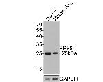 RPS8 Antibody in Western Blot (WB)