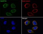 NUDT19 Antibody in Immunocytochemistry (ICC/IF)