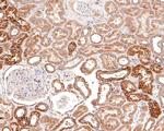 NUDT19 Antibody in Immunohistochemistry (Paraffin) (IHC (P))