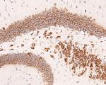 RPL10A Antibody in Immunohistochemistry (Paraffin) (IHC (P))