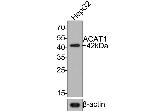 ACAT1 Antibody in Western Blot (WB)