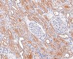 GALT Antibody in Immunohistochemistry (Paraffin) (IHC (P))