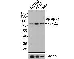 GNE Antibody in Western Blot (WB)