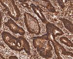 PRPF31 Antibody in Immunohistochemistry (Paraffin) (IHC (P))