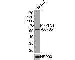 PRPF31 Antibody in Western Blot (WB)