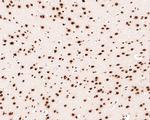 SAFB Antibody in Immunohistochemistry (Paraffin) (IHC (P))