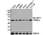 NDUFS2 Antibody in Western Blot (WB)