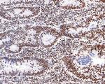 NUP50 Antibody in Immunohistochemistry (Paraffin) (IHC (P))