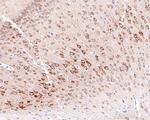 PREPL Antibody in Immunohistochemistry (Paraffin) (IHC (P))