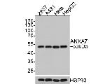 Annexin A7 Antibody in Western Blot (WB)