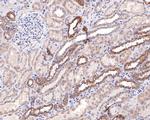 SLC25A12 Antibody in Immunohistochemistry (Paraffin) (IHC (P))