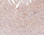 SLC25A12 Antibody in Immunohistochemistry (Paraffin) (IHC (P))