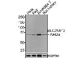 SLC25A12 Antibody in Western Blot (WB)