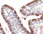 Adiponectin Antibody in Immunohistochemistry (Paraffin) (IHC (P))