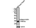 Adiponectin Antibody in Western Blot (WB)