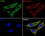 VDP Antibody in Immunocytochemistry (ICC/IF)