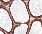 VDP Antibody in Immunohistochemistry (Paraffin) (IHC (P))