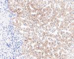 ACADS Antibody in Immunohistochemistry (Paraffin) (IHC (P))