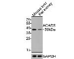 ACADS Antibody in Western Blot (WB)