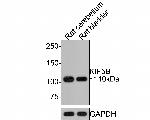 Kinesin 5B Antibody in Western Blot (WB)