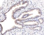 IQGAP2 Antibody in Immunohistochemistry (Paraffin) (IHC (P))