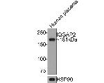 IQGAP2 Antibody in Western Blot (WB)