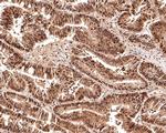 RSK2 Antibody in Immunohistochemistry (Paraffin) (IHC (P))