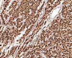 RSK2 Antibody in Immunohistochemistry (Paraffin) (IHC (P))