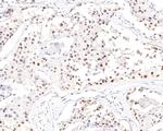 NUP50 Antibody in Immunohistochemistry (Paraffin) (IHC (P))